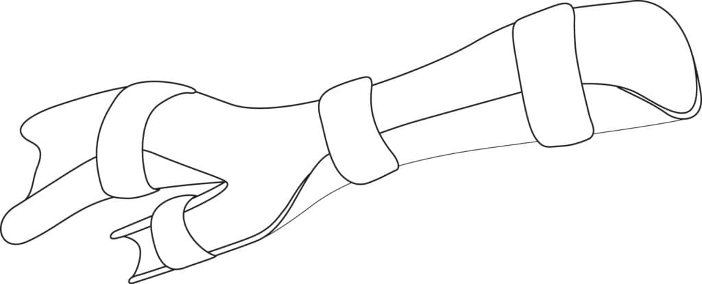 Wrist-Hand Cock-Up Splint - Orthomerica Products, Inc.