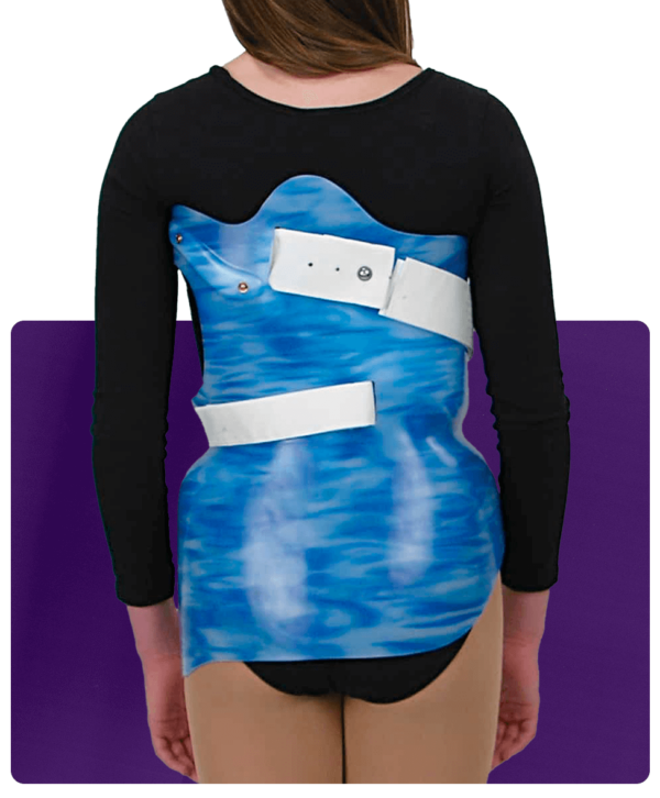 Custom Spinal Orthoses - Image 3