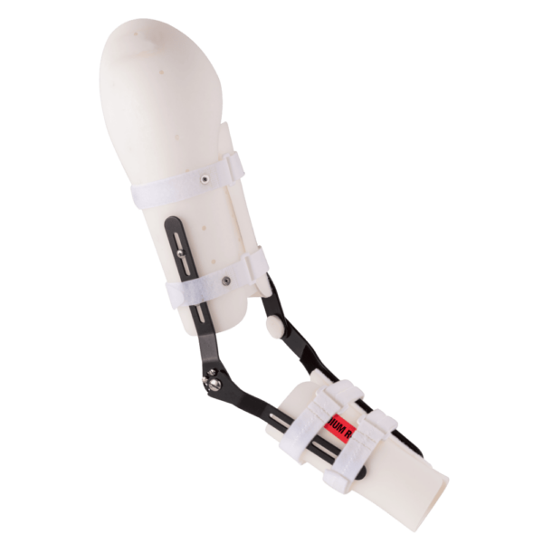 Prime™ Elbow System - with Ulnar Component